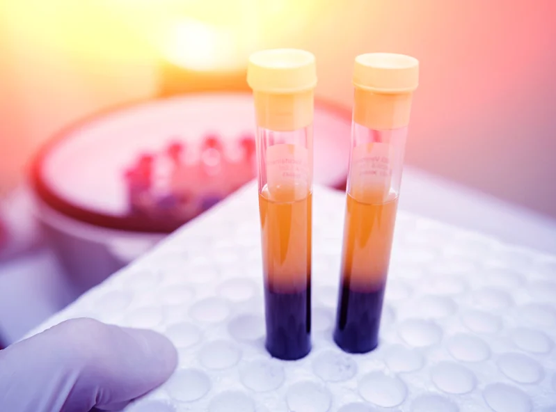 Platelet Rich Plasma and Your Health