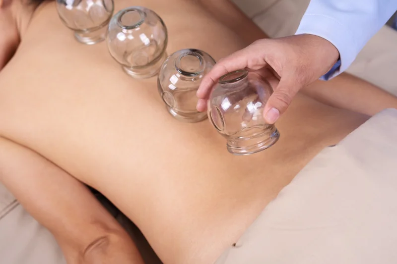 What are the Disadvantages of Cupping?