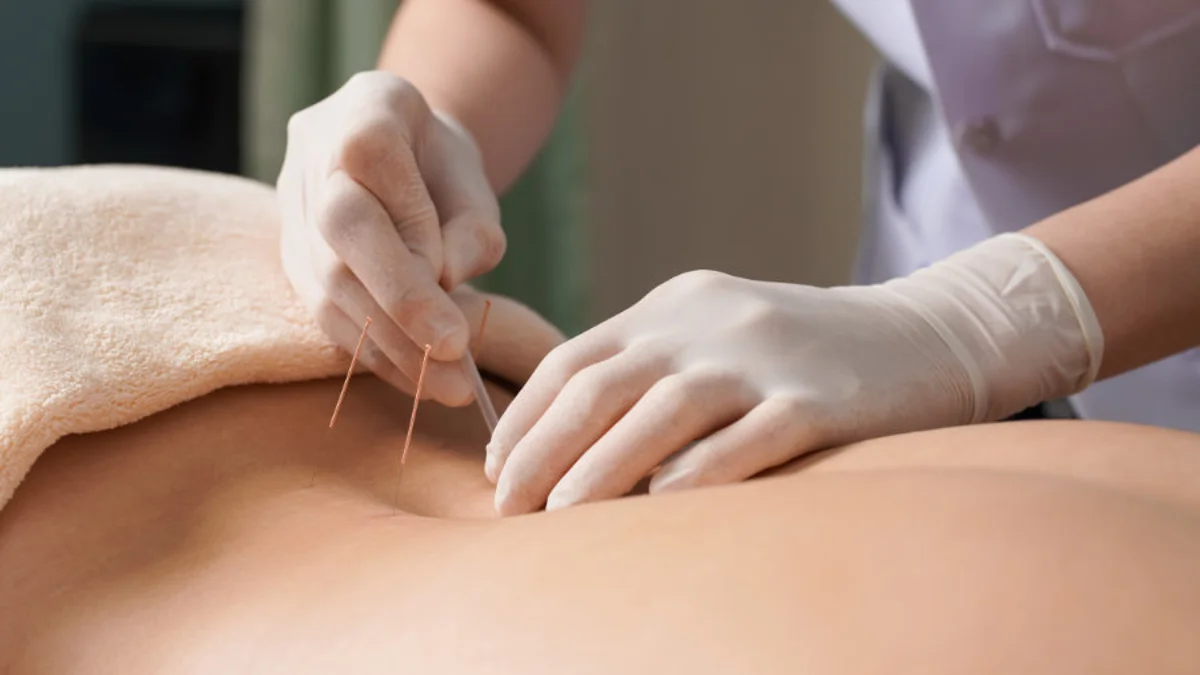 What Does Acupuncture Do For Your Health